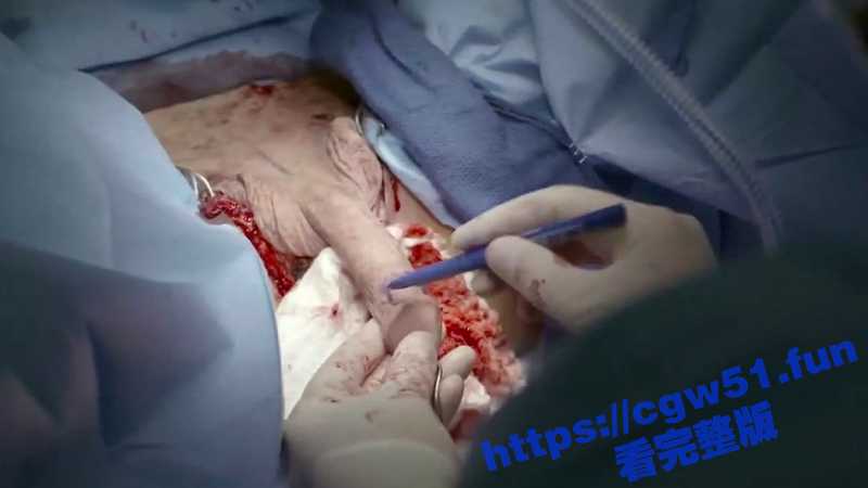 血腥重口 慎入！罕见的医院内部变性手术视频流出 全程皱眉看完 太痛了 - 51吃瓜网-51吃瓜网